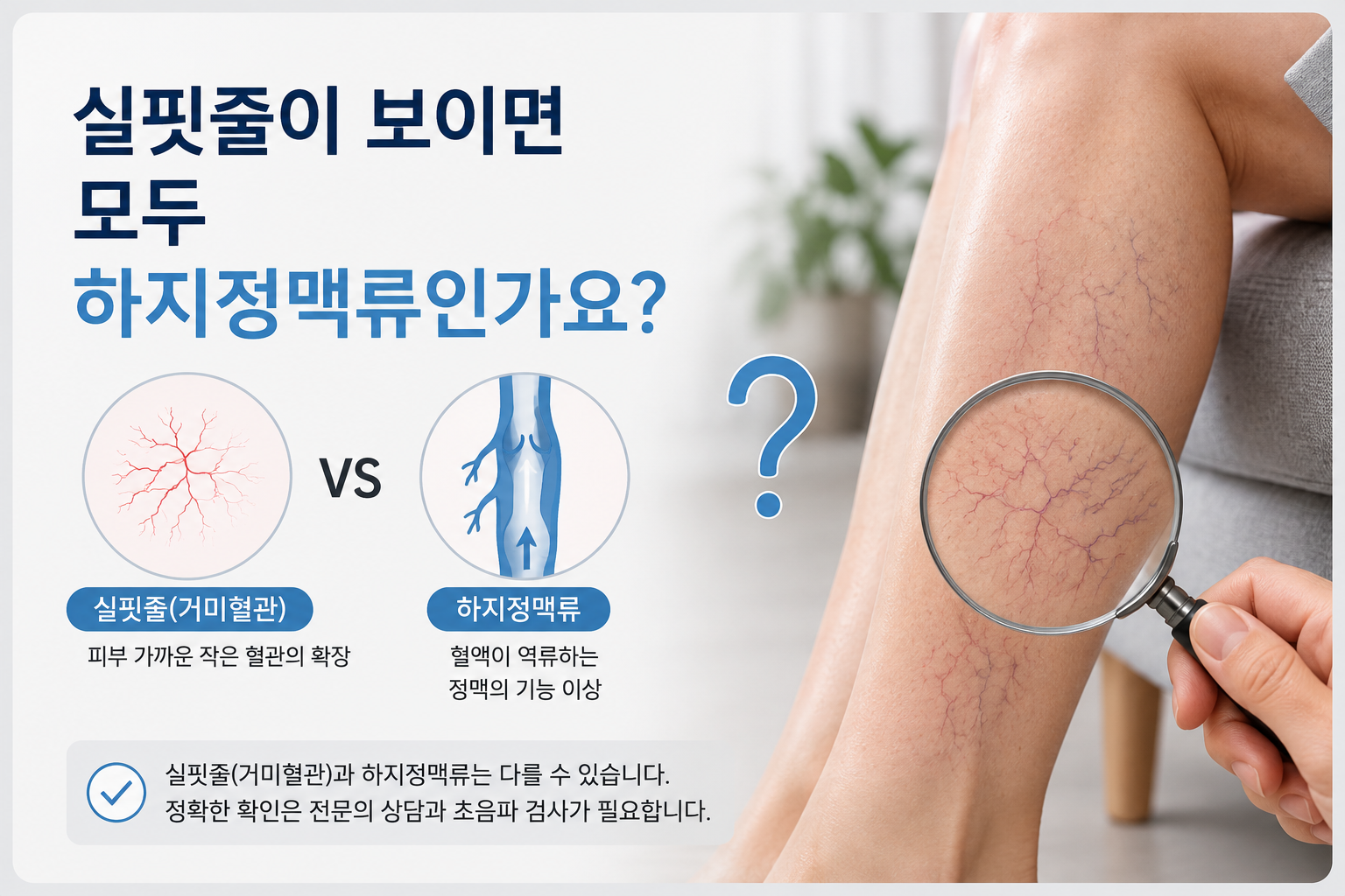 실핏줄이 보이면 모두 하지정맥류인가요?