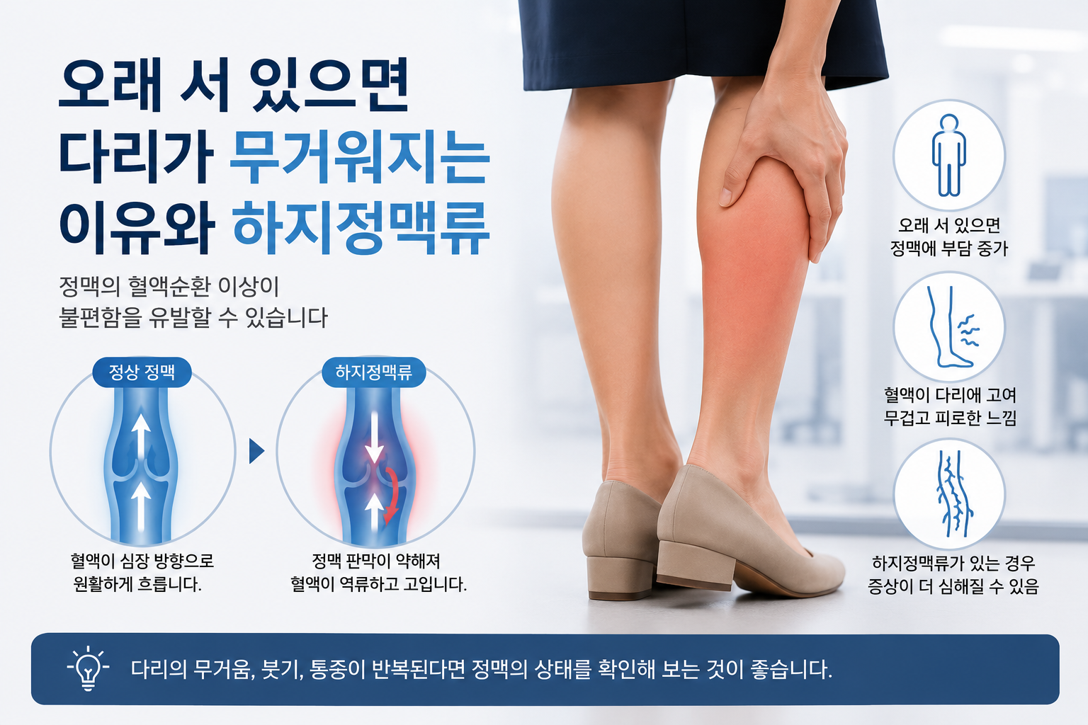 오래 서 있으면 다리가 무거워지는 이유와 하지정맥류